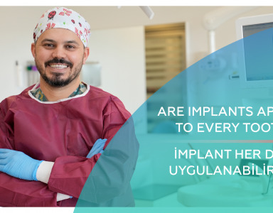 İmplant Her Dişe Uygulanabilir Mi? / Are implants applied to every tooth?