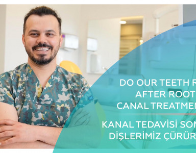 Kanal Tedavisi Sonrası Dişlerimiz Çürür mü/ Do Our Teeth Rot After Root Canal Treatment?